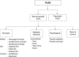 tilt table testing in neurology and