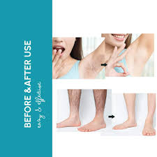 intimate hair removal cream for women