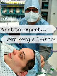 having a c section