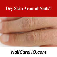 dry skin on hands
