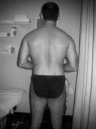 Butt clenching' and 'tail tucking' and its link to back pain - Key Approach