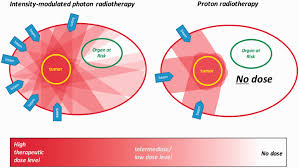 proton therapy technology evolution in