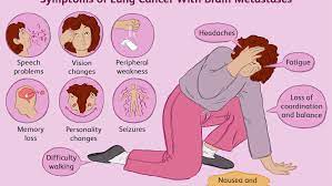 In the case of breast cancer, receiving a stage 4 diagnosis may mean metastasis or metastatic means cancer cells have spread (usually using the blood stream) to another part of the body from the site of origin. Lung Cancer Spread To The Brain Treatments And Prognosis