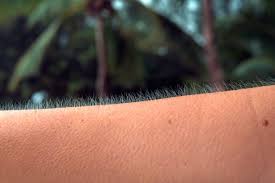 Stine, just for fans of the official goosebumps page! Harvard Study Finds That Stem Cell Stimulation Gives Us Goosebumps
