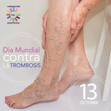 Submit your abstract for isth 2021. Dia Mundial De La Trombosis
