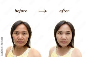 makeup or plastic surgery stock photo