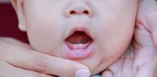 Bayi butuh pemeriksaan lebih lanjut apabila sampai usia 18 bulan belum ada pertumbuhan. Tumbuh Gigi Bikin Bayi Demam Ini Hal Yang Perlu Parents Tahu