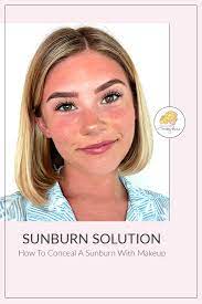 how to cover up sunburn with makeup