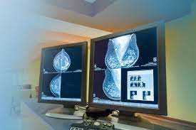 Breast Imaging | UCLA Health - Los Angeles, CA