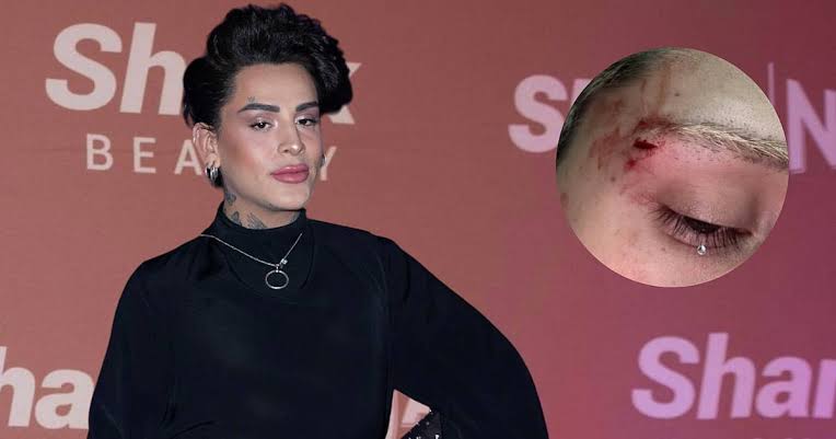 Influencer Kunno denuncia que lo golpearon al salir de un antro: 'Me abrieron la ceja' – El Financiero