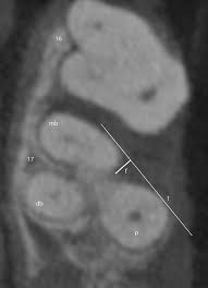 low dose cone beam computed tomography