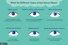 types of eye mucus discharge and boogers