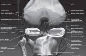 The knee joint is one of the largest and most complex joints in the body. Knee Mri Radiology Key