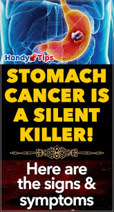 What are treatments for stomach cancer? Stomach Cancer Is A Silent Killer Here Are The Signs Symptoms Social Useful Stuff Handy Tips