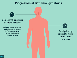 Infant botulism, the most common form, occurs after a baby consumes the bacterial spores, typically by eating contaminated honey. Botulism Overview And More