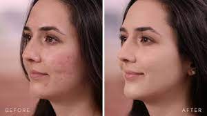 cover fx acne makeup tutorial beauty