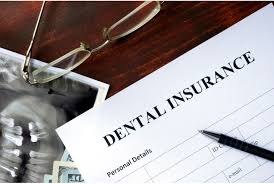 Each state has a specific set minimum amount of liability coverage that they require drivers to carry. Will Dental Insurance Cover My Root Canal Sachem Dental Group