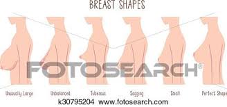 Breast Shape Chart Clipart K30795204 Fotosearch