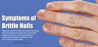 symptoms of brittle nails what