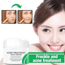 acne treatment cream anti stain scar