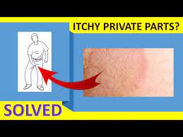 itchy groin area home remedy