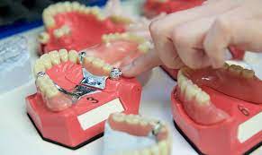 Dentures are full or partial dental prosthesis to replace your missing teeth. Cover Denture Prothese Zpk Herne