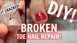 easy toe nail repair red holiday pedi
