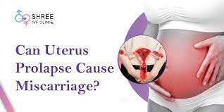 can uterus prolapse lead to miscarriage