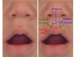 cleft lip anatomy dr derderian