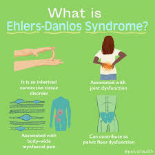ehlers danlos syndrome facts