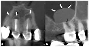 dental and maxillo cone beam