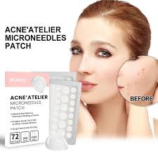 72pcs waterproof acne concealer patch