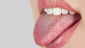 dry mouth causes symptoms side