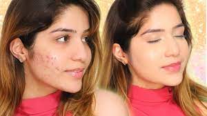 hide acne pimples scars with makeup