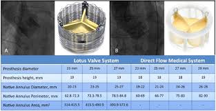 Device Characteristics And Sizing Recommendations For The