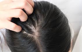 Hair Breakage Business Remedies