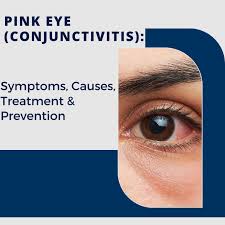 pink eye conjunctivitis symptoms