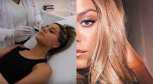 Bianca ingrosso in a selfie as seen in september 2018 (bianca ingrosso / instagram). Bianca Ingrosso Shows The Result After The Beauty Attack Best I Ve Done