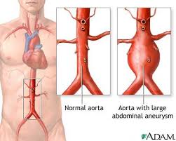 Many organs are located in or close to the central plane; Abdominal Mass Information Mount Sinai New York