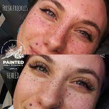 semi permanent freckle tattoos the