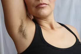 ingrown hairs with laser hair removal