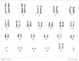 Chromosome 47
