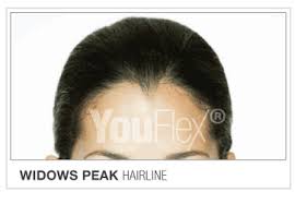 Hairline Shape Chart Youflex Blog