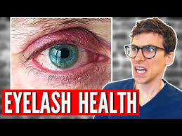 eyelid hygiene how to treat