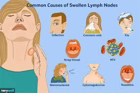 causes of lumps on the neck