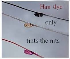 It is believed that some hair dyes containing hydrogen peroxide will kill lice. Myth Buster Mondays Hair Color Kills Super Lice And Lice Eggs