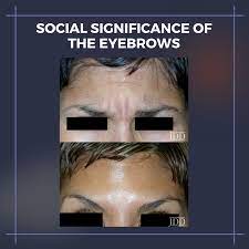 eyebrows and periorbital complex