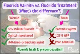 fluoride varnish vs fluoride treatment