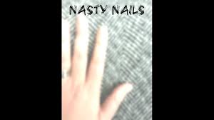 wtol 11 special report nasty nails