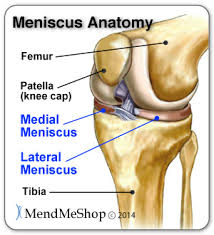 meniscus tear wiki